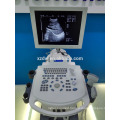 medical diagnostic trolley ultrasound machine dw-370